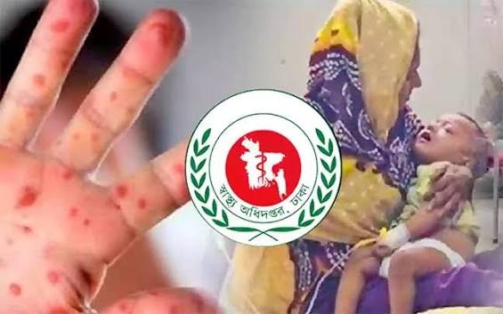 হামের উপসর্গে আরও ২ শিশুর মৃত্যু