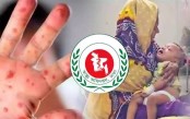 হামের উপসর্গে আরও ২ শিশুর মৃত্যু